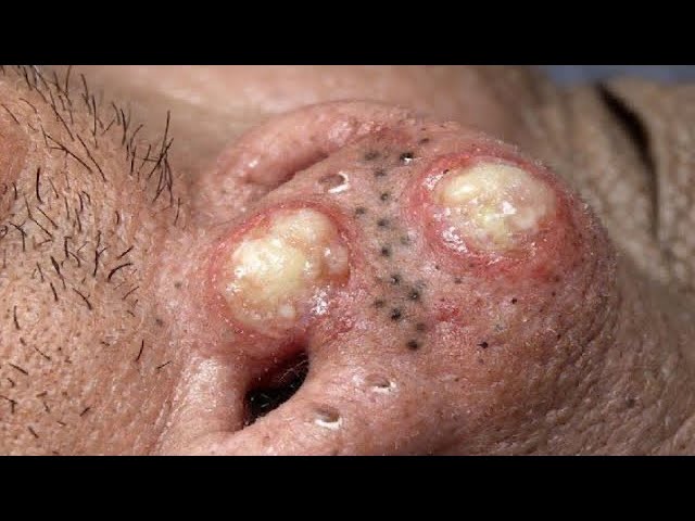 𝑺𝒐𝒐𝒕𝒉𝒊𝒏𝒈 𝑭𝒂𝒄𝒊𝒂𝒍 𝑻𝒓𝒆𝒂𝒕𝒎𝒆𝒏𝒕 𝑭𝒐𝒓 𝑺𝒕𝒓𝒆𝒔𝒔 𝑹𝒆𝒍𝒊𝒆𝒇 𝒂𝒕 𝑳𝒖𝒙𝒖𝒓𝒚 𝑺𝒑𝒂 𝑨𝒄𝒉𝒊𝒆𝒗𝒆 𝑰𝒏𝒏𝒆𝒓 𝑷𝒆𝒂𝒄𝒆 #5003864