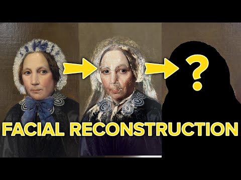 Facial Reconstruction