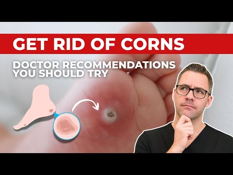 How to REMOVE Thick Dry Skin, Calluses & Corns [HOME Remedies]