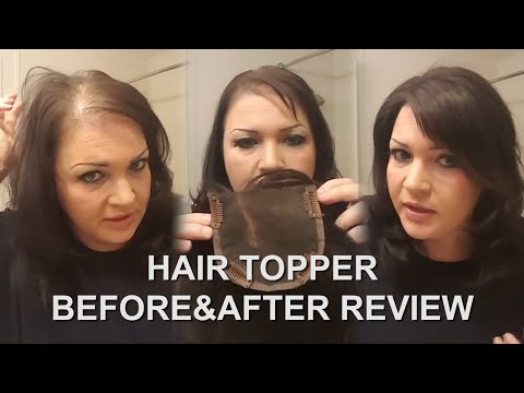Human Hair Topper Review, How-To, Before&After,...