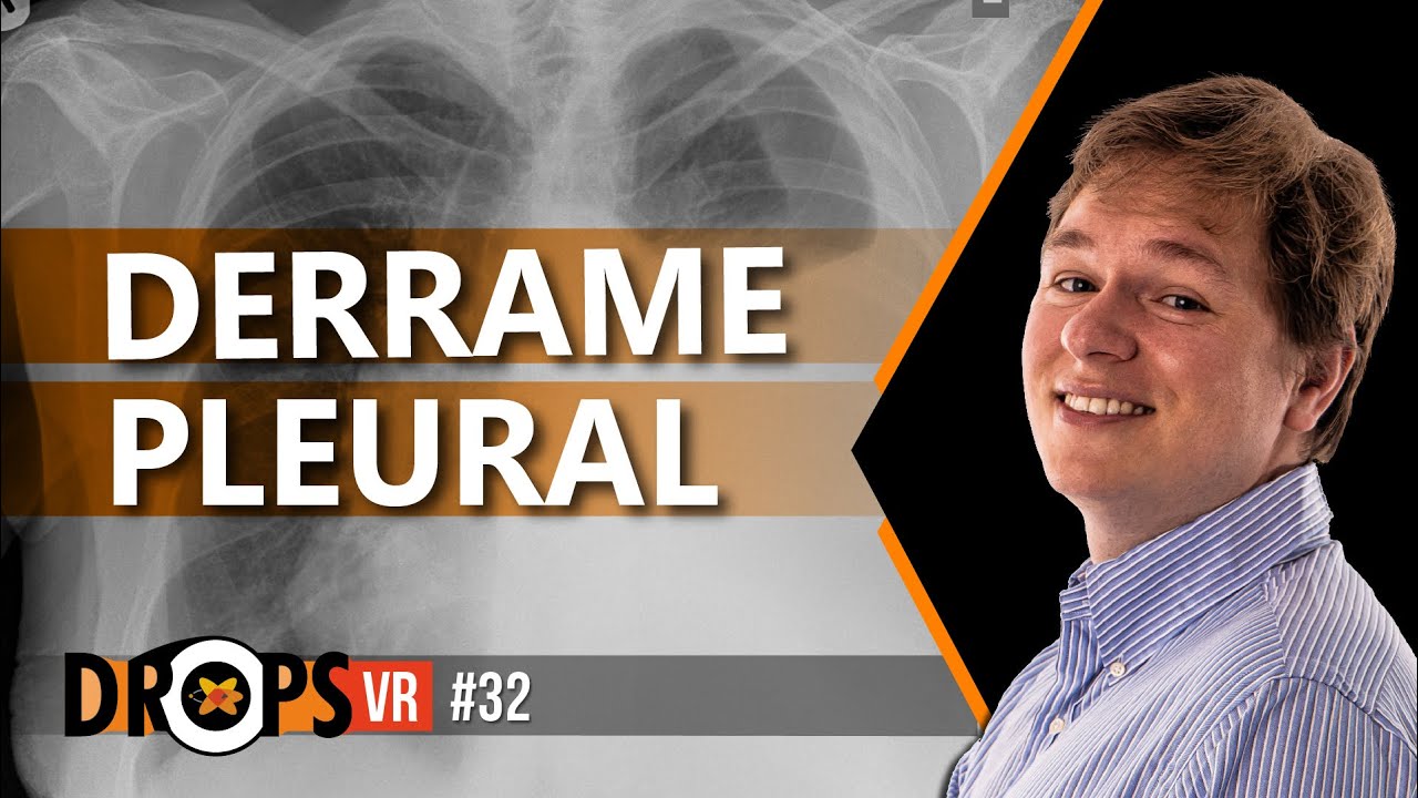AVALIAÇÃO POR IMAGEM DO DERRAME PLEURAL