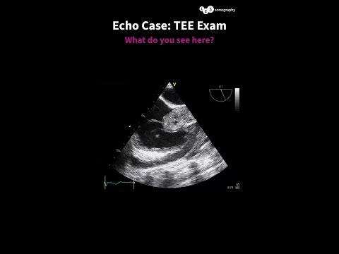 What do you see here? 🧐