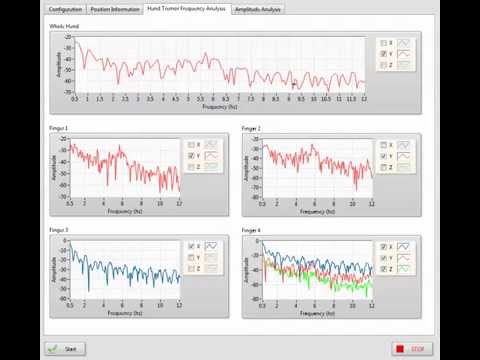 Hand Tremor Analysis