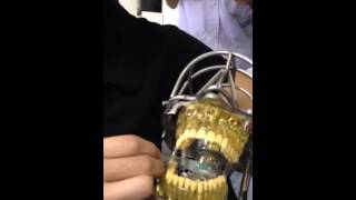 Anestesi Infiltrasi & Blok Mandibula