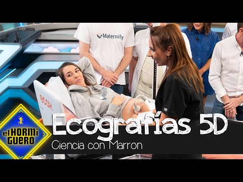 Ecografías en 5D: Uno de los experimentos más enternecedores - El Hormiguero