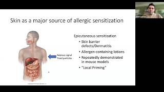 [Daniel  Waizman] Skin damage signals mediate allergic sensitization to spatially unlinked antigen
