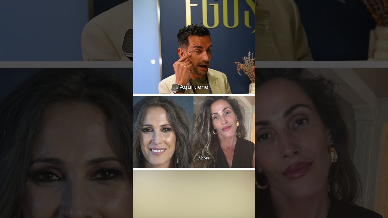 ¡Malú ya no luce igual! 😱 Antes y Después de sus retoques estéticos