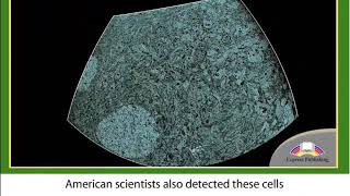 Action The Rosehip Neurone 11grade