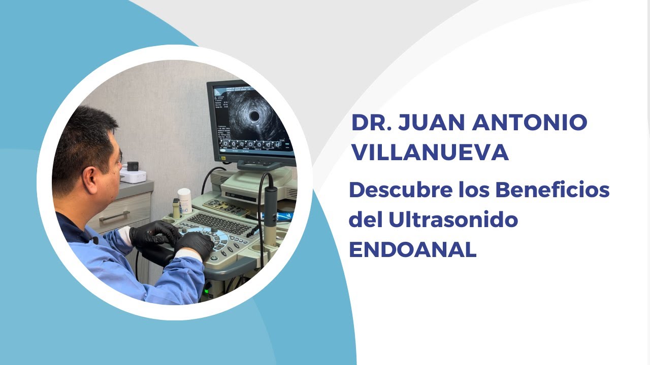 Juan Antonio Villanueva Herrero-8