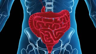 Ileus @LearningSurgeryMD #subscribe #illustration #viral #digestivehealth #digestivesystem