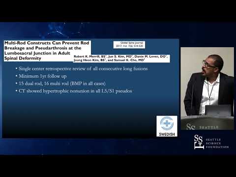 Complex Spine Revisions and Multi Rod Constructs - Amir Abdul Jabbar, MD