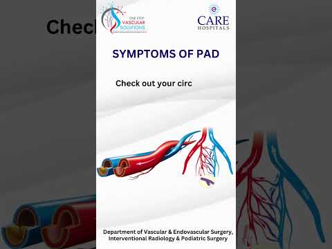 PAD | One-stop vascular solutions | Dr. RAHUL AGARWAL | Dr. P.C GUPTA