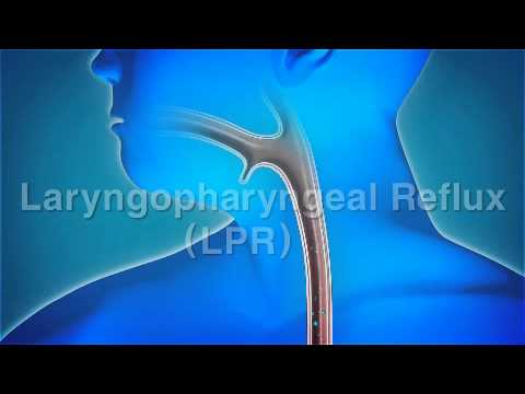 Mechanism of action - Proton pump inhibitors
