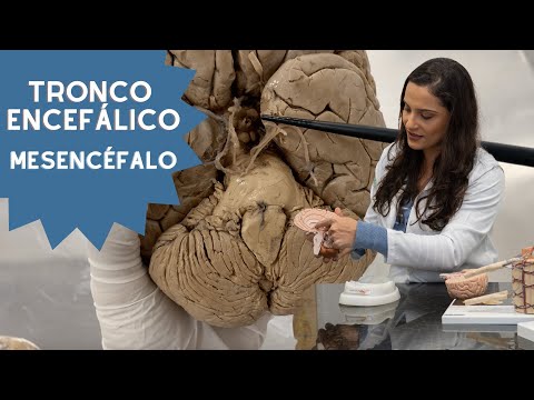 Brainstem: Midbrain (understand where Parkinson's Disease occurs)