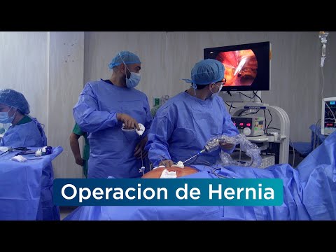 Telecapacitación de la Hernia - Hospital Nacional &quot;Dos de Mayo&quot;, video de YouTube