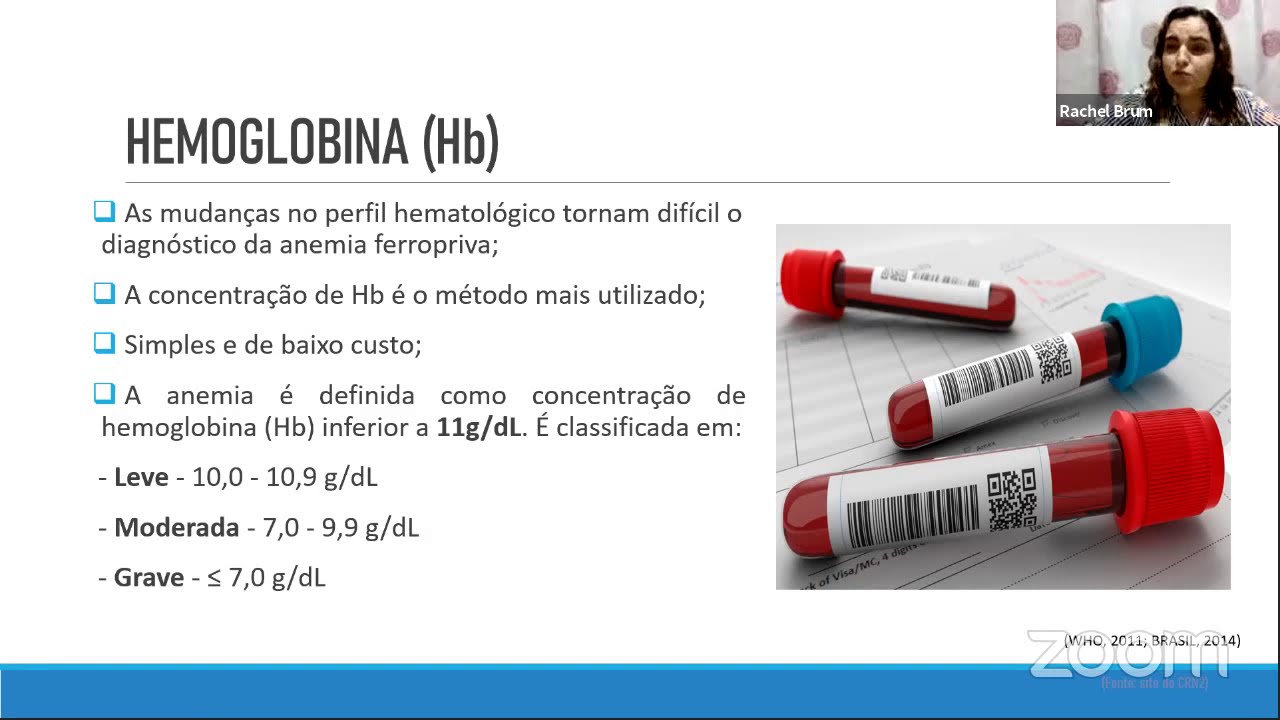 XXIV Encontro de Nutrição IFF/Fiocruz - 02/10/2020 - tarde - 14h00 - 15h40