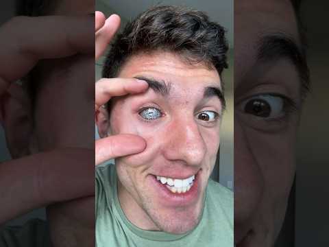 I GOT A CHROME EYEBALL 😳