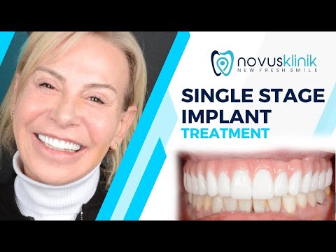 Logo of Fast, Pain-Free Dental Implants Abroad – What You Need to Know in Istanbul, Turkey