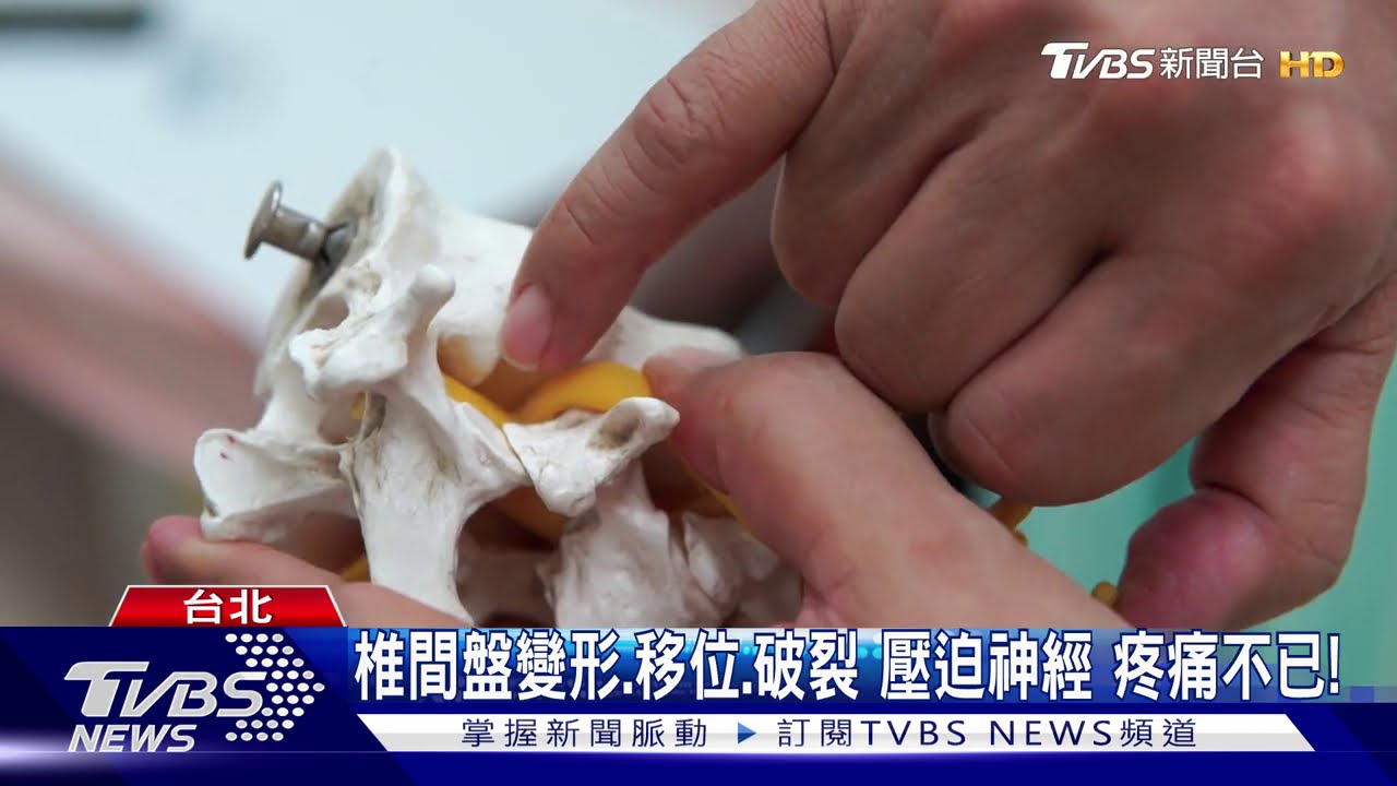 低頭滑手機、姿勢不良!恐導致「椎間盤突出」 壓迫神經劇烈疼痛