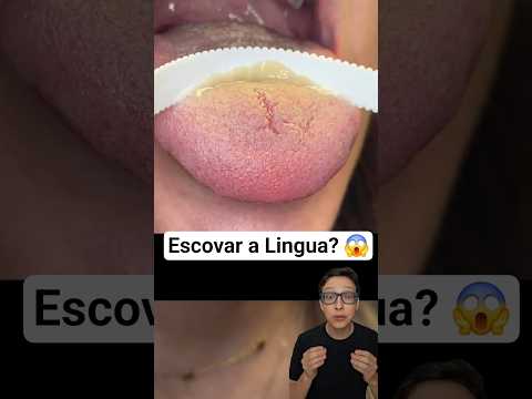 Escovar a Língua 😱#medicina #medico #enfermagem #enfermeiro #enfermeira #dentista #odontologia