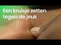Helpt een kruisje zetten in een muggenbult tegen de jeuk? | NOJ | Het Klokhuis
