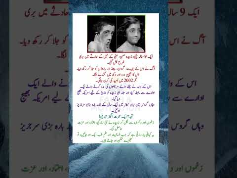 Burned at 9, Reborn Through Hope — The True Story of Zubaida!| motivation #realstory