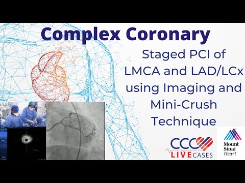 Staged PCI of LMCA and LAD/LCx using Imaging and Mini-Crush Technique