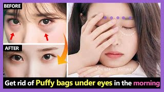 Only 2 Mins!! How to get rid of Puffy bags under eyes and Swollen under eyes in the morning quickly.