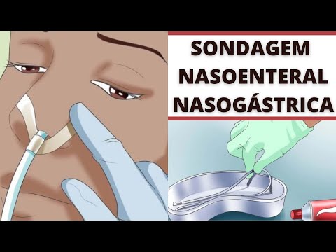 NASOENTERAL AND NASOGASTRIC TUBE PROCEDURE