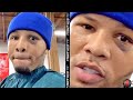 GERVONTA DAVIS SHOWS OFF BLACK EYE FROM LEO SANTA CRUZ FIGHT; BACK TO TRAINING FOR NEXT FIGHT
