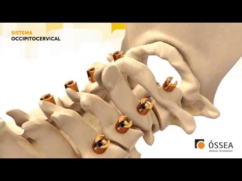 Se io intervertebrale ernia che cosa è la malattia Mi fa male luomo tira il basso addome inferiore della schiena