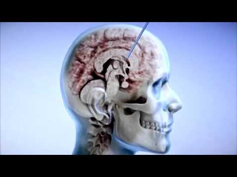 Inventor Arminas Ragauskas from LITHUANIA