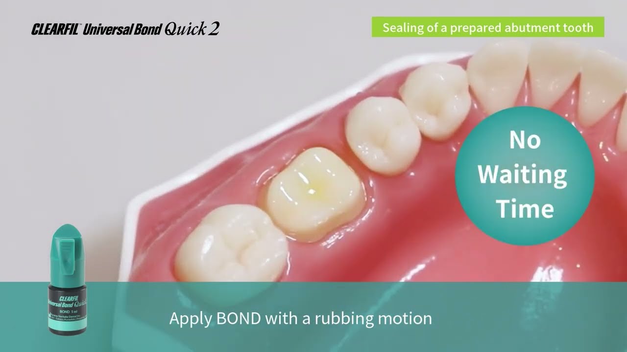 6. Sealing of A Prepared Abutment Tooth