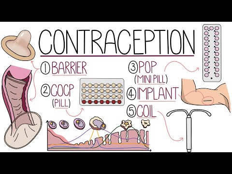 Methods of Contraception Made Easy (Contraceptive Methods Explained)