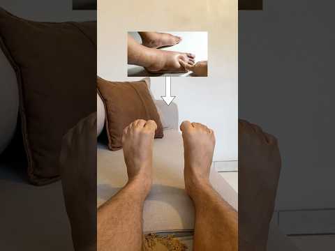 Pés e tornozelos inchados podem ser curados com estes exercícios #exercíciofísico