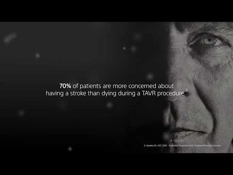 Protected TAVR with SENTINEL™ Cerebral Embolic Protection