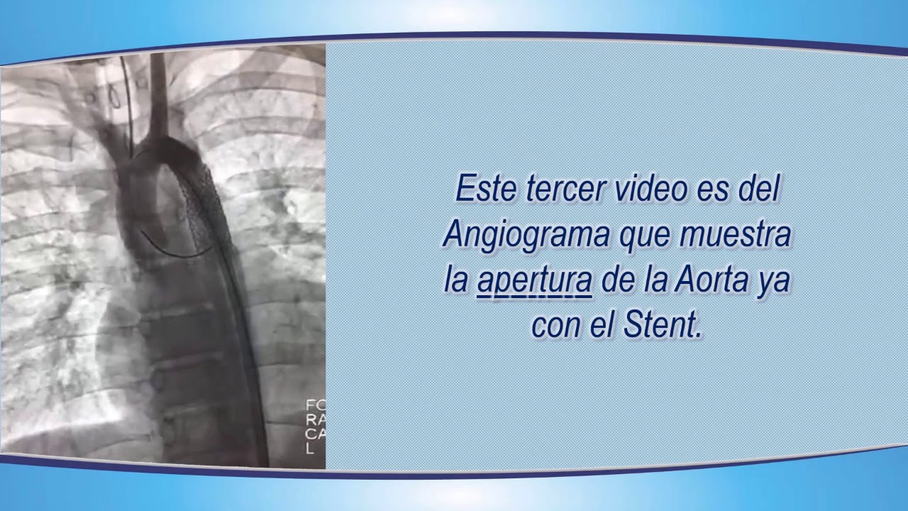 Carlos Alberto Aguirre Molina-21