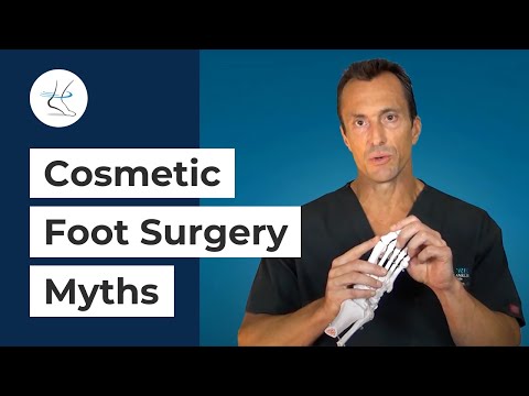 Cosmetic Toe Shortening Long Toe Surgery Video Without Metal Pins