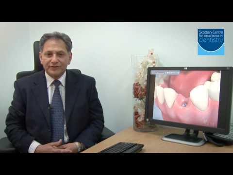 Scottish Centre for exc in Dentistry cosmetic dentists glasgow dental implants  PT