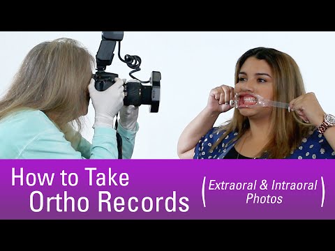 How to Take Orthodontic Records - Step by Step