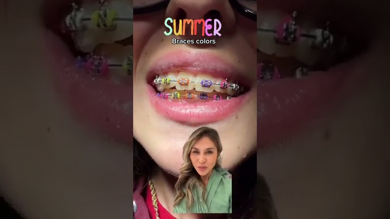Best Braces Colors-Summer Colors Combo