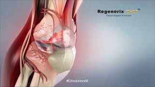 Regenerix Gold Joint Supplement | Relieve Pains without Injection & Surgery | Tissue Repair Formula