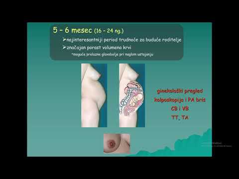 download lagu mp3 mp4 Trudnicki Kalendar, download lagu Trudnicki Kalendar gratis, unduh video klip Trudnicki Kalendar