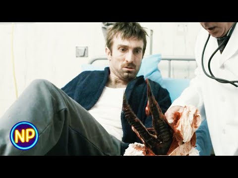 District 9 | What's Happening to My Arm