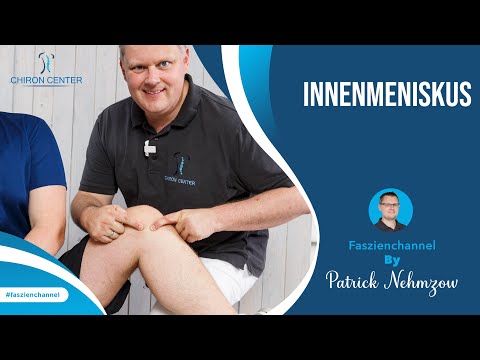 Warum am Knie der Innenmeniskus kaputt geht – obwohl Du gar keinen Unfall hattest