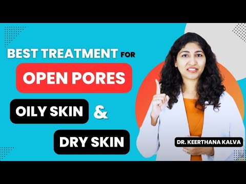 Best Treatment for Open Pores | Inform Clinics | Dr. Keerthana Kalva | Skin care Tips