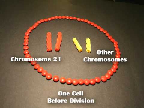 Nondisjunction (Trisomy 21) - An Animated Tutorial