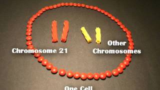 Down Syndrome - Molecular Basis
