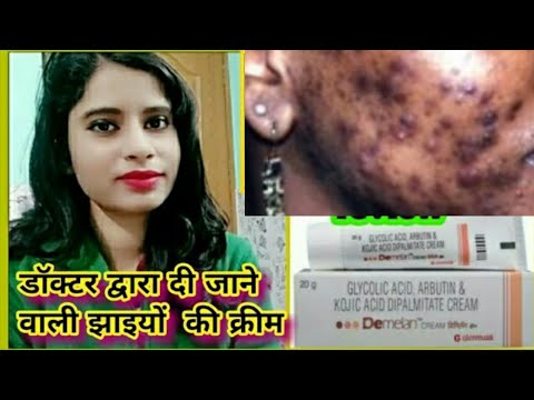 Demelan Cream - Benefits, side effects and Uses