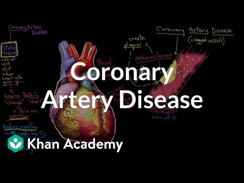 What is Coronary Artery Disease?